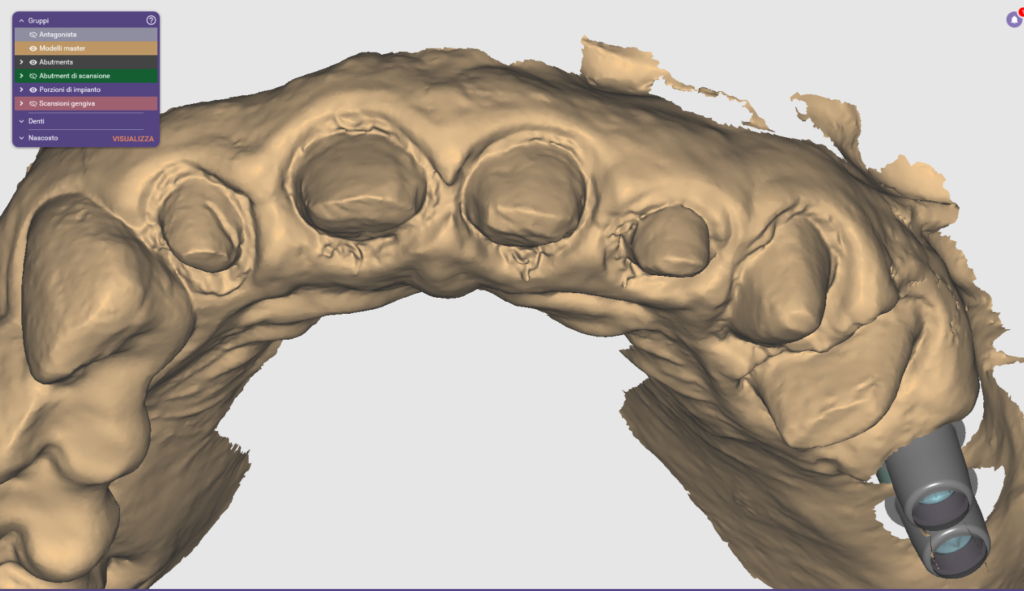 scansione intraorlae